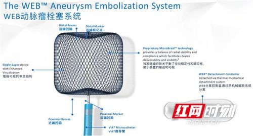 新技术丨永州市中心医院在全市率先完成web瘤内扰流装置置入